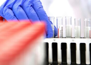 Chinese Scientist invent Covid-19 test that shows result in 4 min