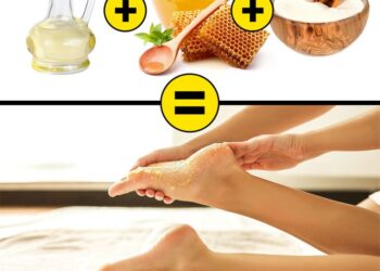 Easy home remedies to treat cracked heels