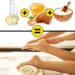 Easy home remedies to treat cracked heels