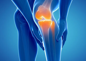 Arthritis: Early warning signs in women, effects you need to know