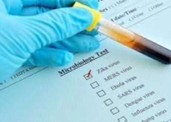 Karnataka On Alert As First Case Of Zika Virus Surfaces
