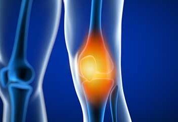 How to take care of your bone and joint health in winters