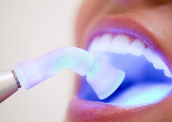 Oral cancer, according to doctors, begins when the DNA in the cells inside your mouth is harmed. However, certain factors, such as your eating habits, may raise your risk. Here are some things to keep in mind: Do not smoke or use tobacco products, and drink alcohol in moderation (and refrain from binge drinking). Maintain a well-balanced diet. Limit your time in the sun. Repeated exposure raises the risk of lip cancer, particularly in the lower lip. Use blocking sun protective lotions on your skin and lips when out in the sun.