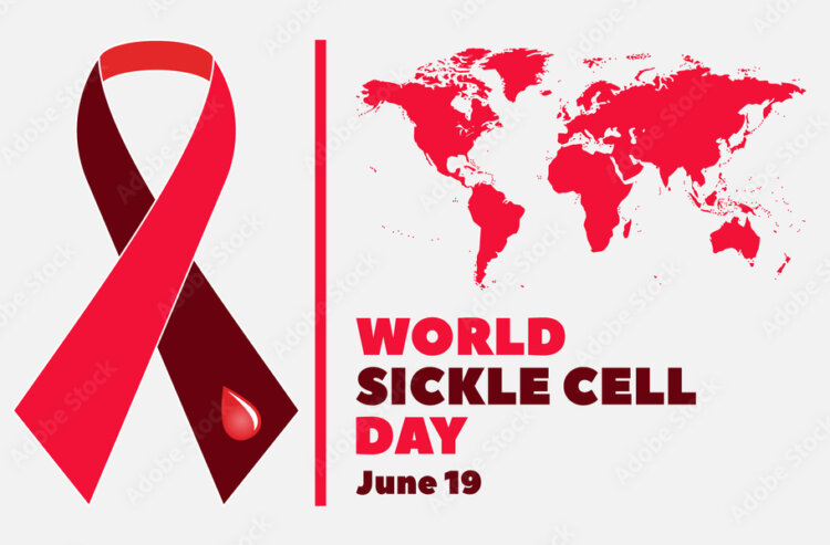 World Sickle Cell Awareness Day 2023: 5 Major Warning Signs Of Sickle Cell You Should Not Ignore
