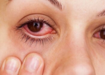 Conjunctivitis & Monsoon: Effective Tips to Prevent Pink Eyes during the Rainy Season