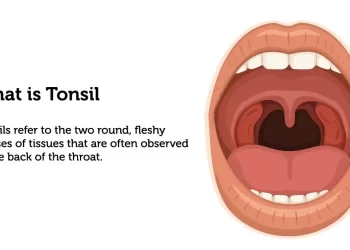 Monsoon Health Kit: Tonsils in Rainy Season; Ways To Manage It