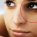 Dark Circles: Here’s how you can get rid of it