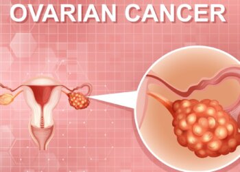 Ovarian Cancer: 6 Early Symptoms And Health Risks Women Should Never Ignore