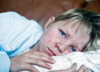 Measles Outbreak 2024: 5 Easy Home Precautions To Protect Yourself From Contagious Virus