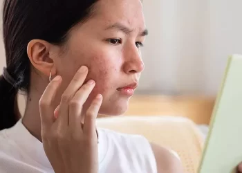 Acne Treatment: 8 Dietary Choices To Make To Get Clearer Skin