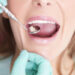 Oral cancer: 8 early signs and symptoms that you should not avoid