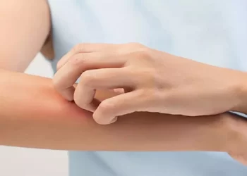 Fungal infections during monsoon: Essential tips for healthy skin and nails