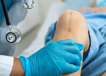 Knee Replacement Surgery: Consider These Essential Factors Before Undergoing The Treatment