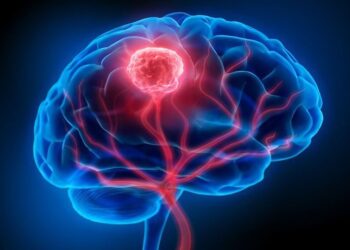 Brain Tumour: Neurosurgeon reveals 5 habits to boost brain health