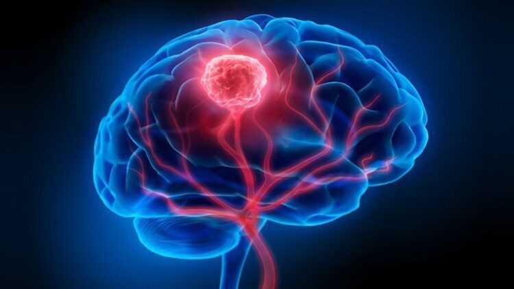 Brain Tumour: Neurosurgeon reveals 5 habits to boost brain health