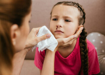 Nose Bleeding: Know The Most Effective Home Remedies