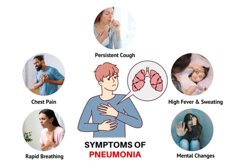 Pneumonia: Know the symptoms and causes