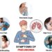 Pneumonia: Know the symptoms and causes