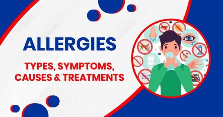 Allergies: Types, Symptoms, Treatment & Management