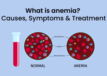 Anaemia - symptoms, causes and treatment