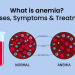 Anaemia - symptoms, causes and treatment
