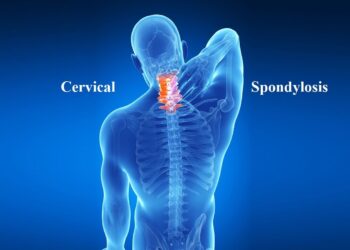 Cervical spondylosis