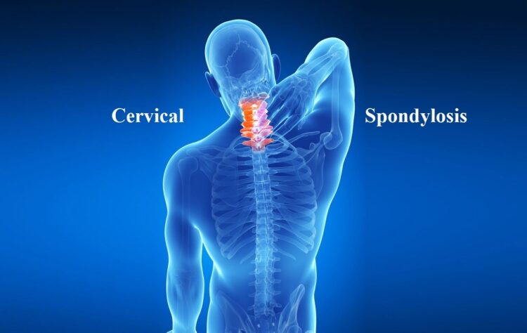 Cervical spondylosis