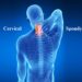 Cervical spondylosis