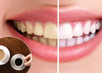 Tea, coffee or cola: Which drink stains your teeth the most?