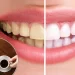 Tea, coffee or cola: Which drink stains your teeth the most?